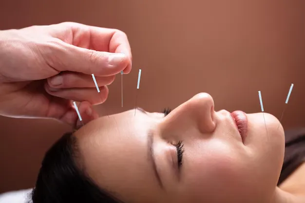 Acupuncture clinic in Woodbridge
